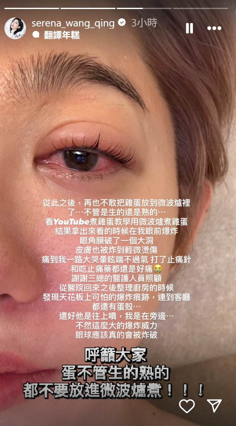 女星王晴曬出一張眼睛和周圍皮膚的傷照。(圖/翻攝自王晴 IG)