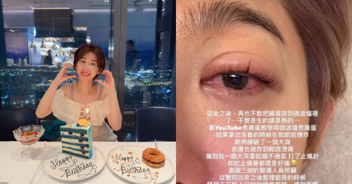 王晴先前使用微波爐加熱雞蛋爆炸,導致眼角膜破洞、皮膚燙傷。(圖/翻攝自王晴IG)