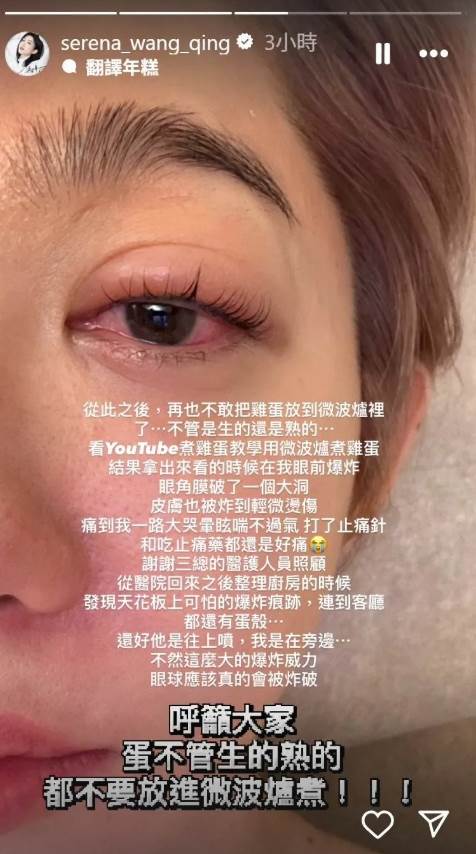 王晴曝光爆炸經過。（圖／翻攝自王晴IG）
