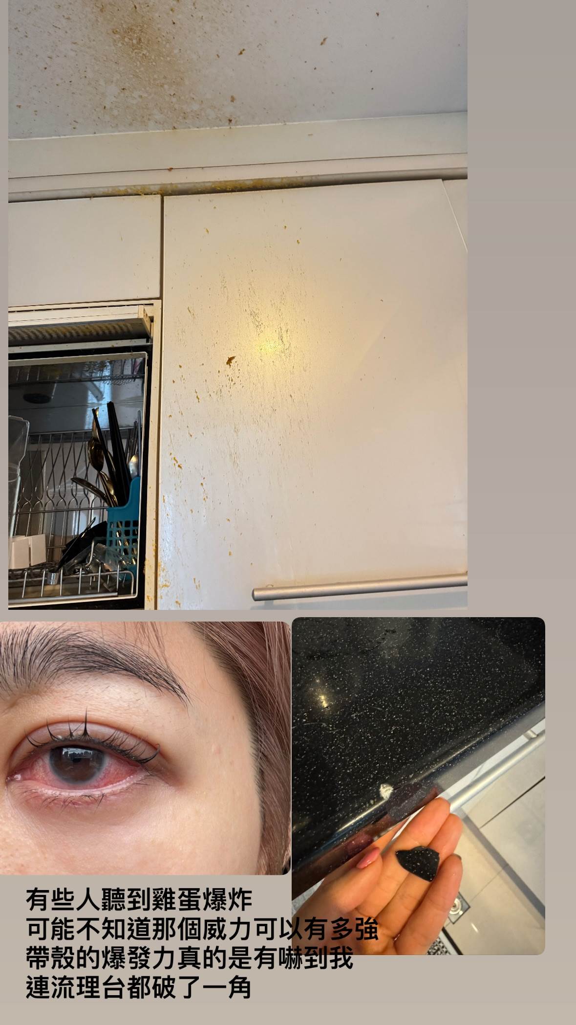 王晴曬出事發現場照片，並透露至今仍需要打止痛針減緩疼痛。（圖／翻攝自王晴IG）