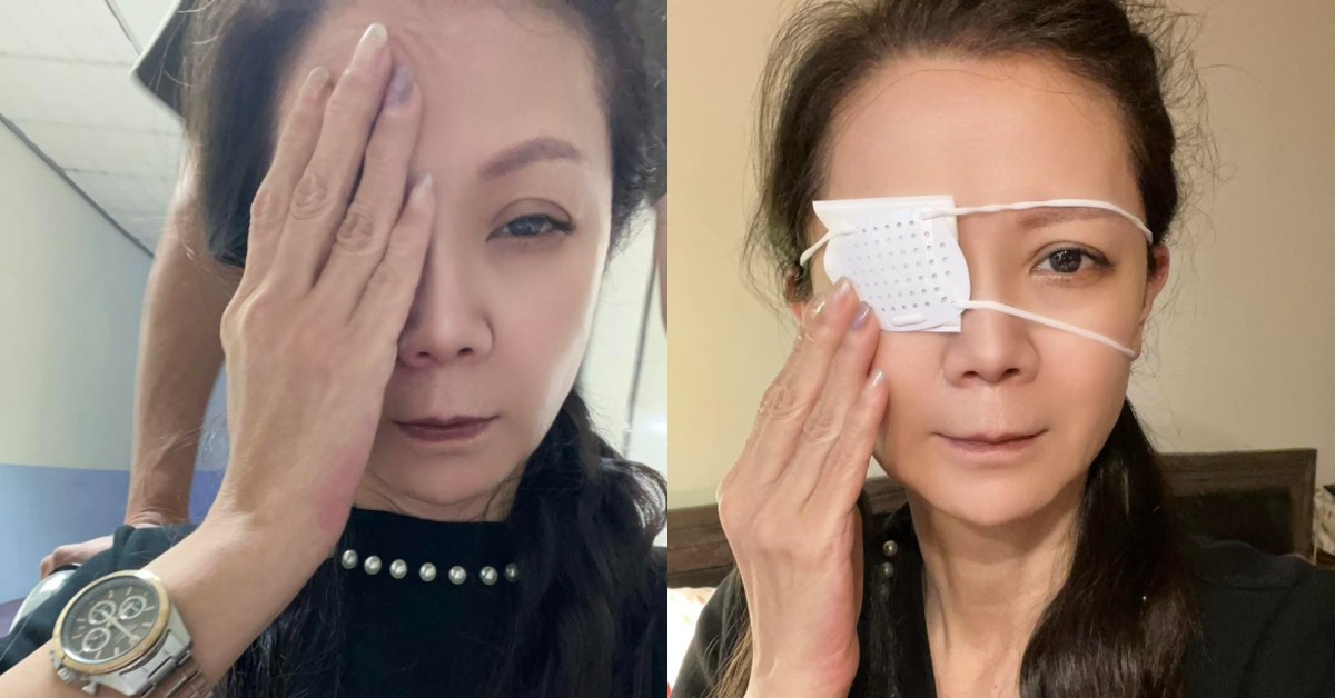 55歲八點檔女星高欣欣PO出眼睛受傷的照片。(圖/翻攝自高欣欣臉書)