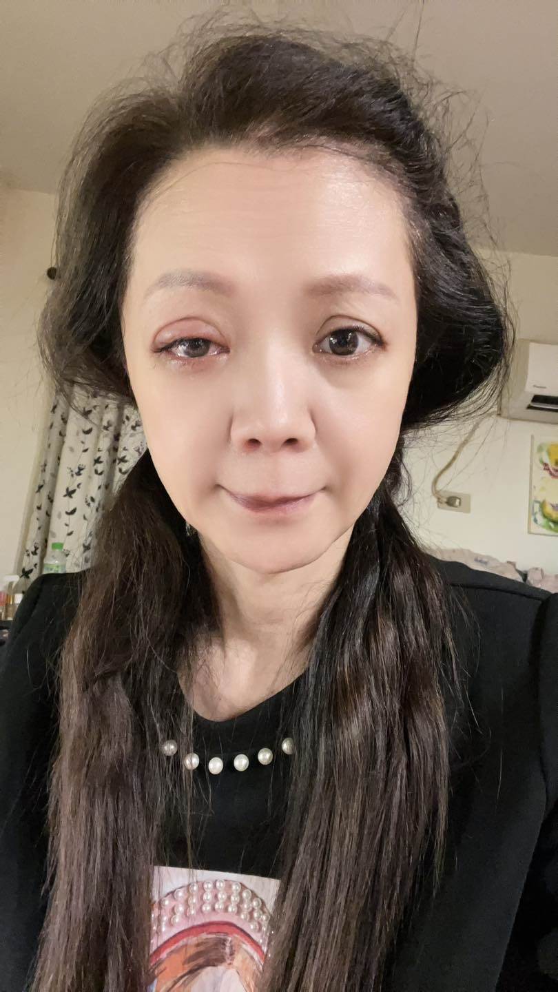 高欣欣曬出傷勢照片。(圖/翻攝自高欣欣臉書)