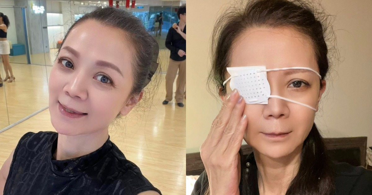 女星高欣欣誤將處理傷口的藥水當作眼藥水點在眼睛，最新傷勢曝光。（圖／翻攝自高欣欣臉書）