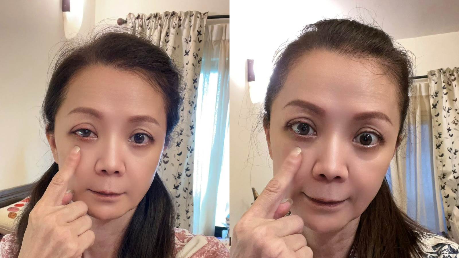 高欣欣向粉絲報平安，透露<a href='https://star.ebc.net.tw/search/keyword?value=傷勢' target='_blank'>傷勢</a>已經好很多。（圖／翻攝自高欣欣臉書）