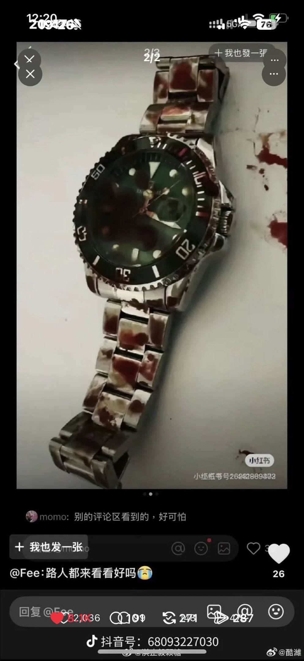 于朦朧離世時候，被爆出拿著2個勞力士手錶。（圖／翻攝自微博）