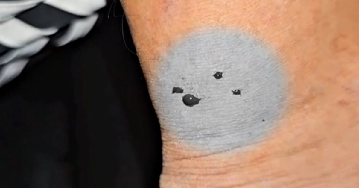 YouTuber Crazy熊哥被赤尾青竹絲咬傷小腿。（圖／翻攝自臉書Crazy熊極限戶外活動頻道 ）