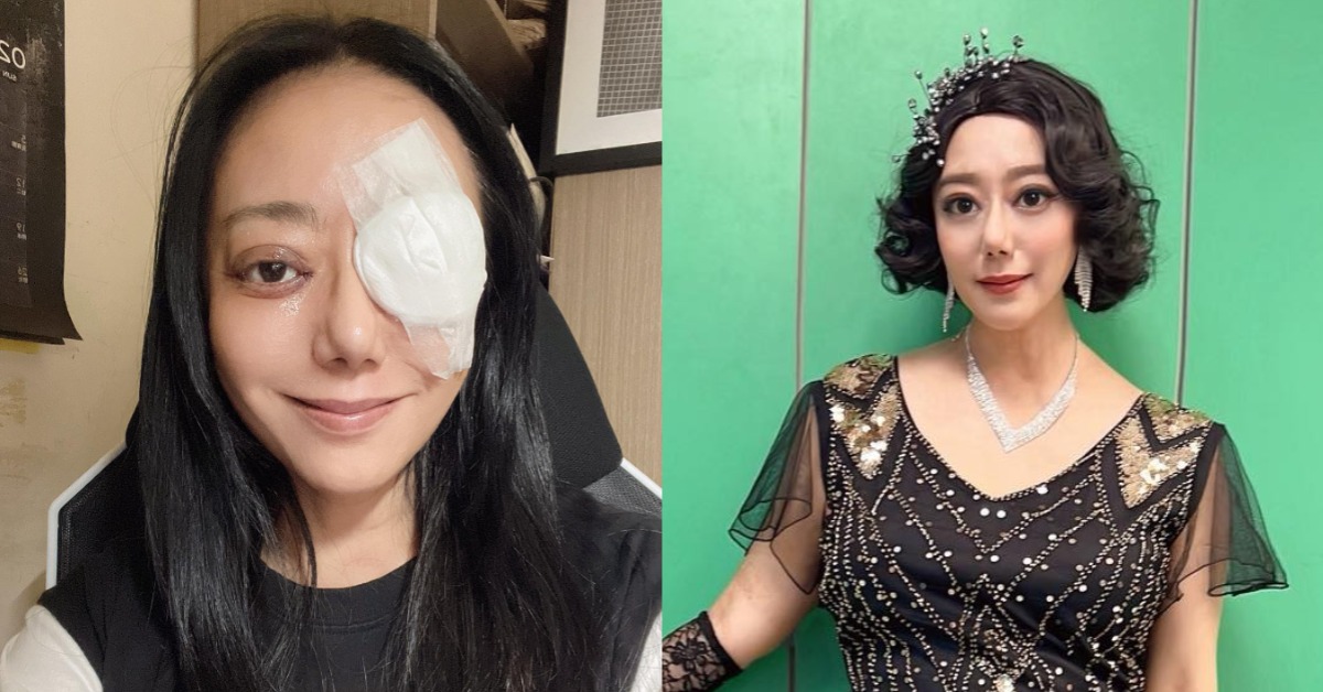 高慧君因甲狀腺低下導致眼睛垂直斜視。（圖／翻攝自高慧君臉書）