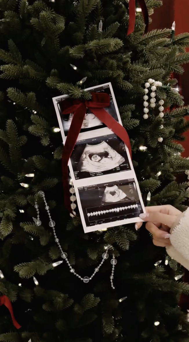 簡廷倪曬出超音波照。（圖／翻攝自簡廷倪Instagram）