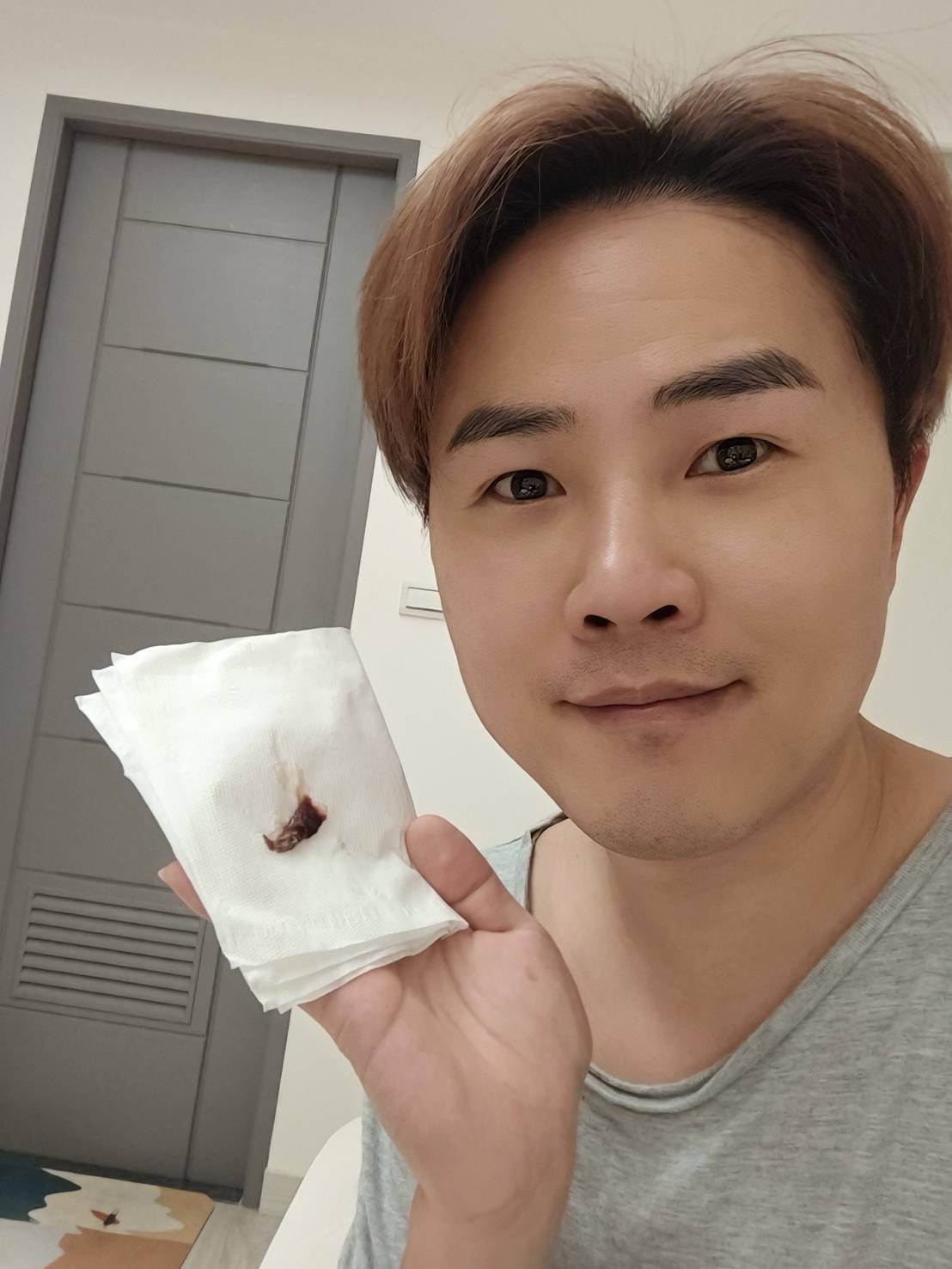 陳孟賢接受鼻炎微創手術擤出大片血塊。（圖／全球巨星有限公司）