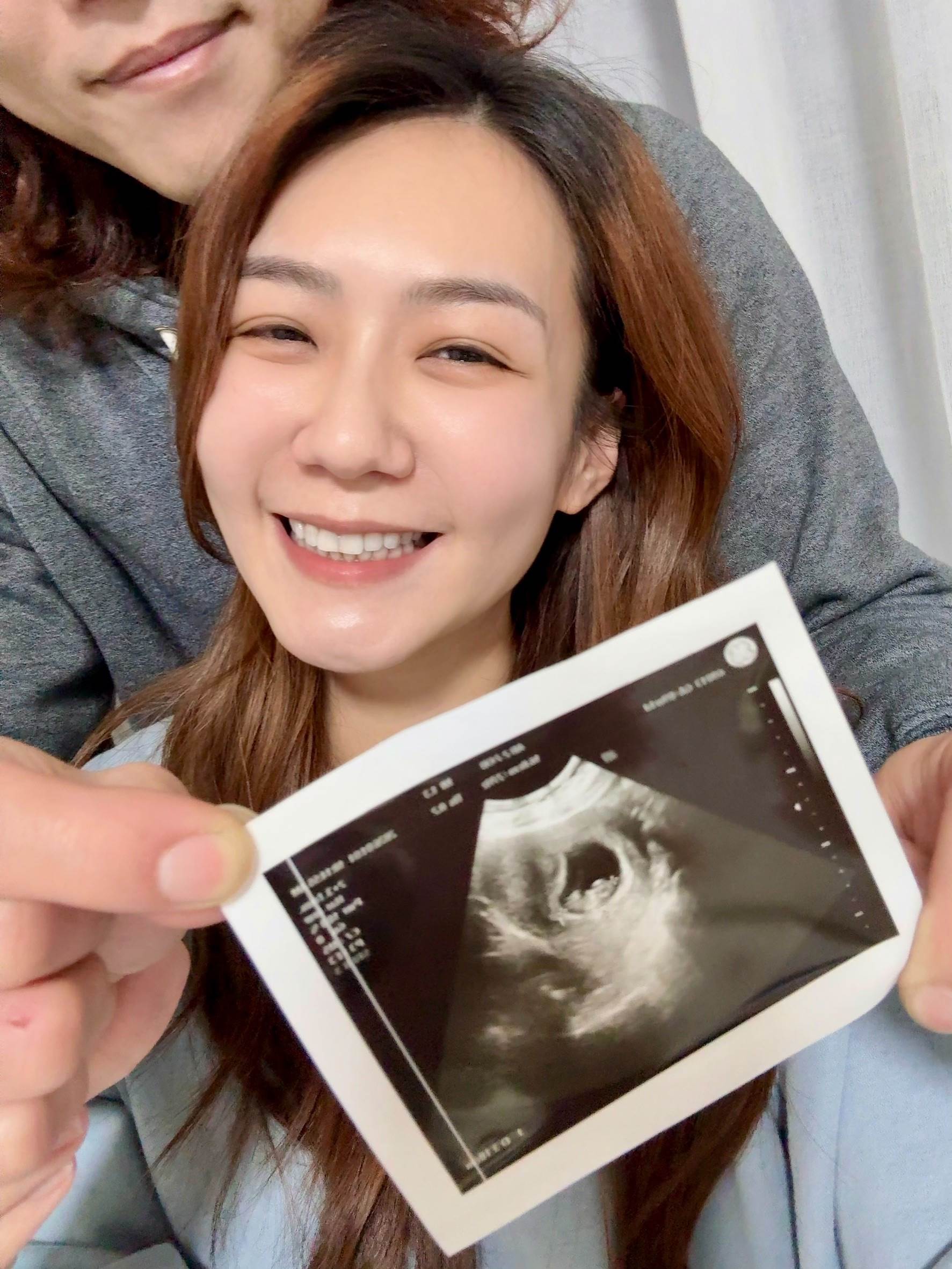 李又汝曬超音波照分享喜悅。（圖／民視提供）