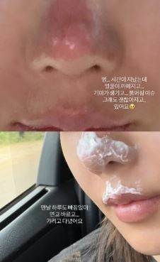 權恩妃在攻頂之後，發現她受傷了。（圖／翻攝自權恩菲IG）