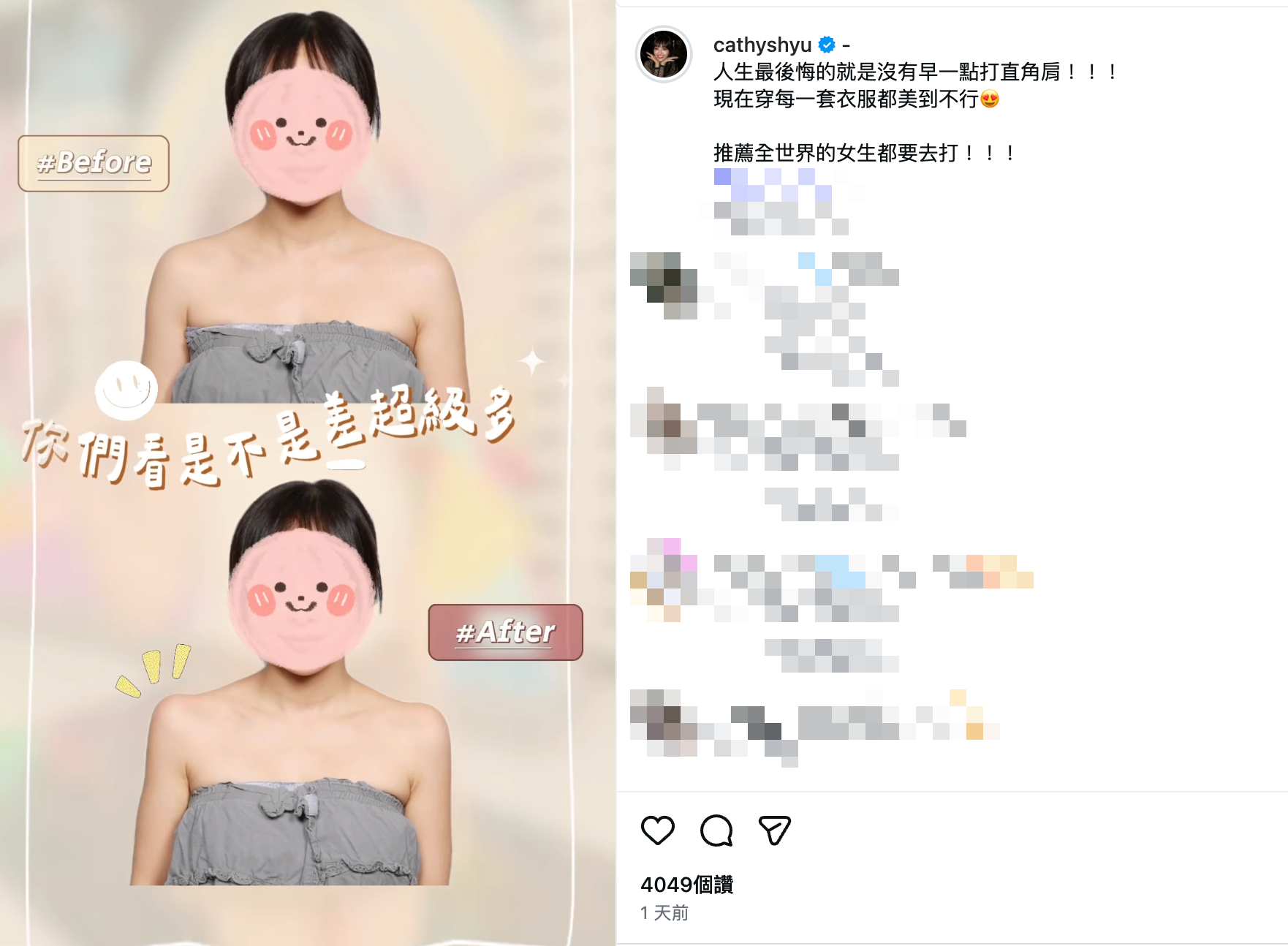 徐凱希分享赴南韓打造直角肩成果。（圖／翻攝自徐凱希IG）