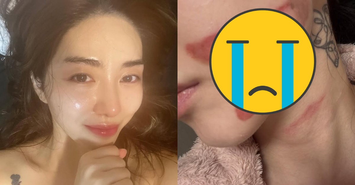 南韓女團AOA前成員權珉娥近日遭到醫療事故。（圖／翻攝自權珉娥 IG）