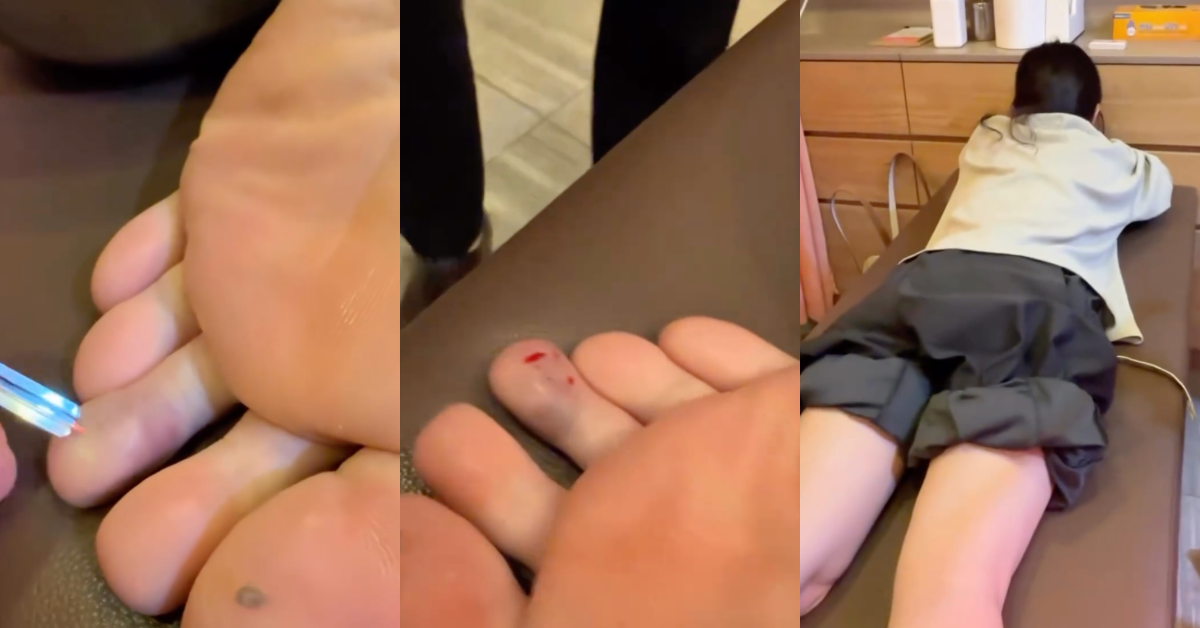 Ella的腳趾受傷了。（圖／翻攝自Ella Instagram）