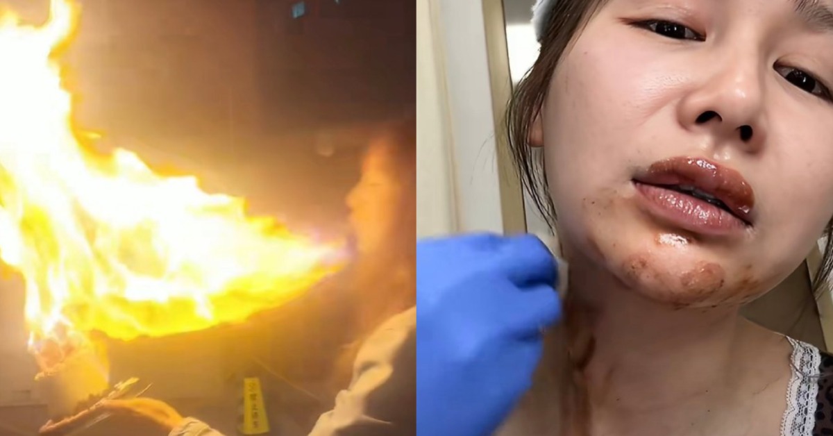 中國27歲女星王添羽被「噴火蛋糕」回火反撲。（圖／翻攝自微博@大肥皂）