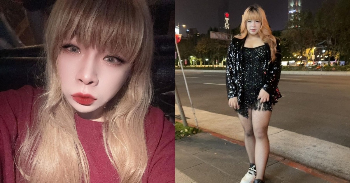 網紅珮珮兒，日前騎車途中遭違規跨越雙黃線的汽車撞飛，雙手雙腳多處擦傷。（圖／翻攝自佩佩兒臉書）