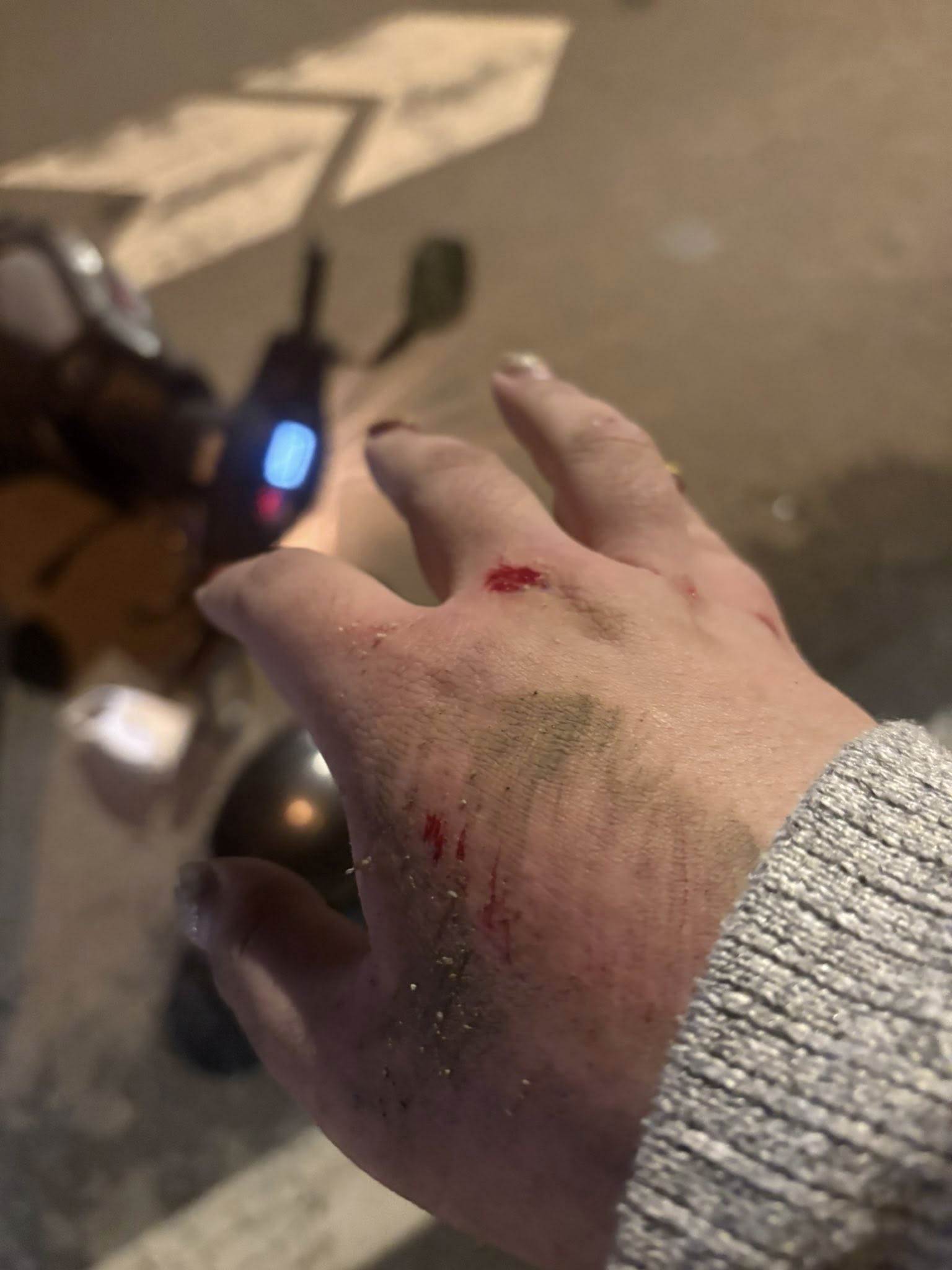 珮珮兒遭違規車輛撞飛，手部、膝蓋均有擦挫傷。（圖／翻攝自<a href='https://star.ebc.net.tw/search/tags/佩佩兒/' target='_blank'>佩佩兒</a>臉書）