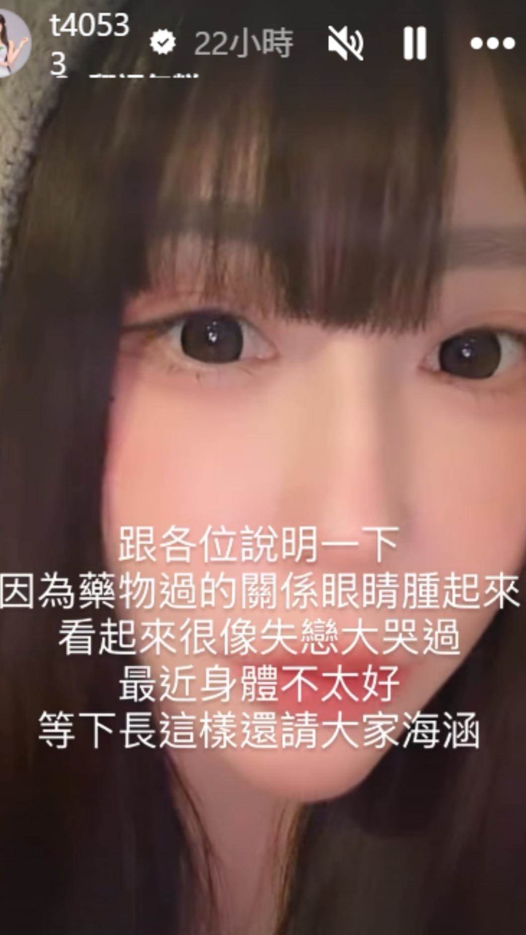 梓梓因藥物過敏導致雙眼浮腫。（圖／翻攝自梓梓IG）