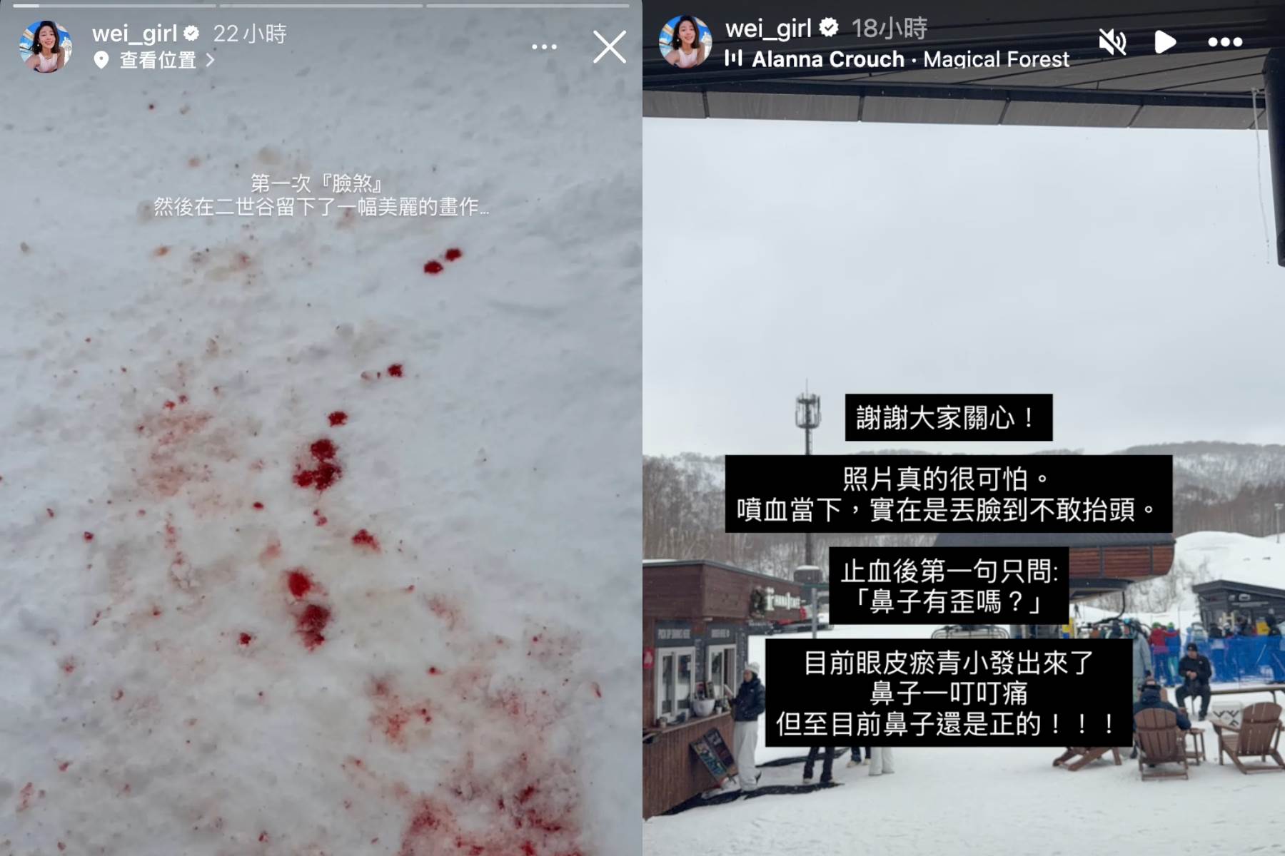 黃薇渟滑雪噴飛後血染雪地。（圖／翻攝自黃薇渟IG）
