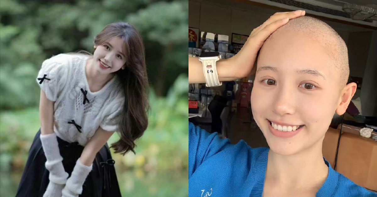 抖音千萬粉絲的網紅一栗小莎子（徐依莎）為抗癌剃光頭。（圖／翻攝自微博）