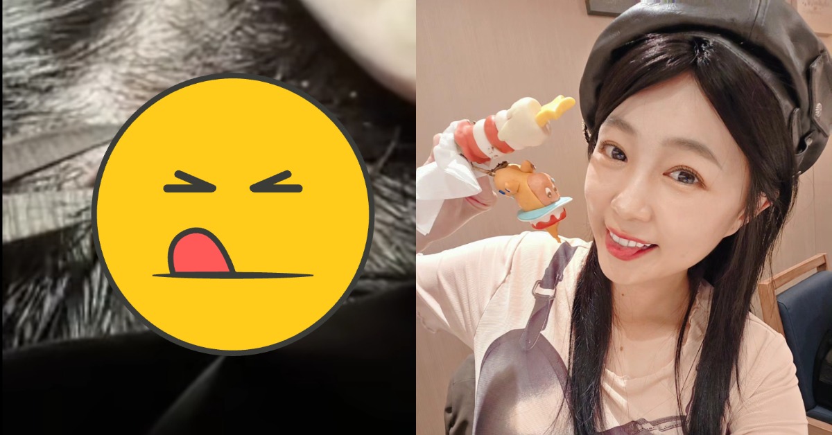 女星丫頭（詹子晴）在生日當天頭部摔傷縫5針。（圖／翻攝自丫頭臉書）