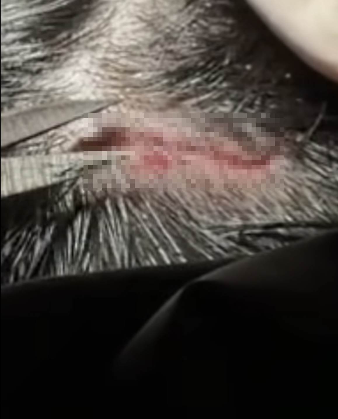 女星丫頭（詹子晴）曬出了處理傷口的影片。（圖／翻攝自丫頭臉書）