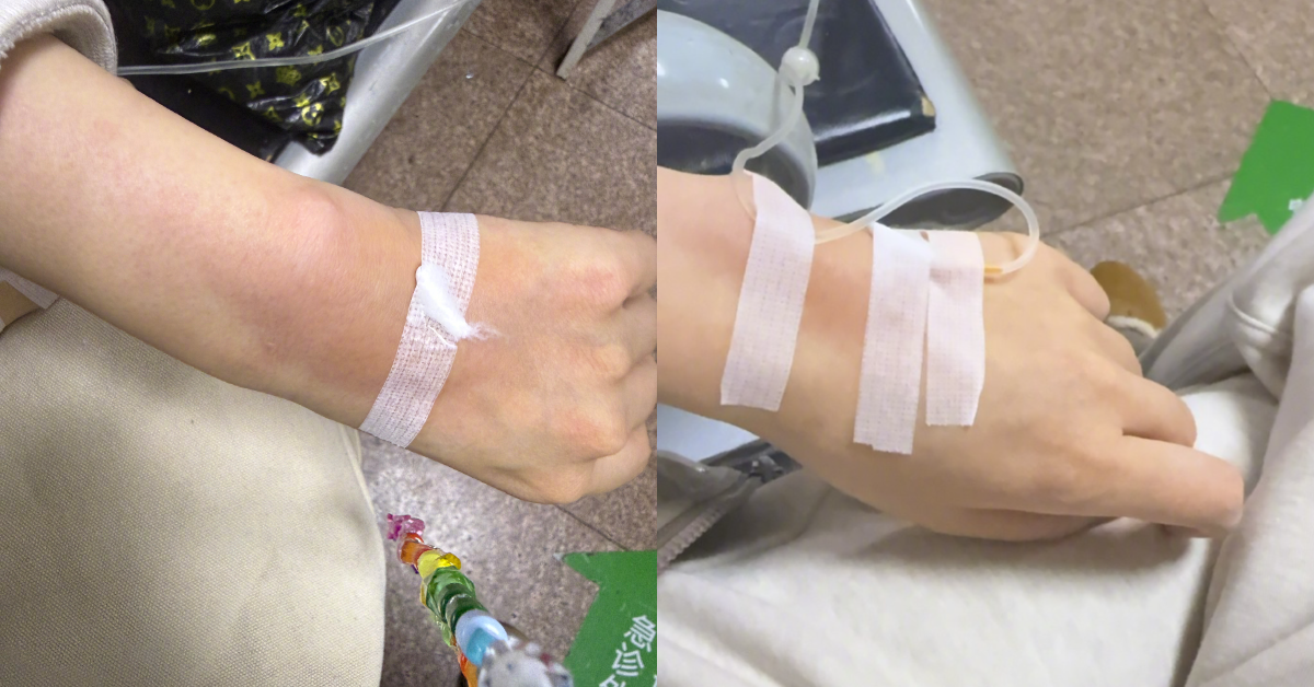 王曉晨吃藥不適就醫。（圖／翻攝自王曉晨微博）