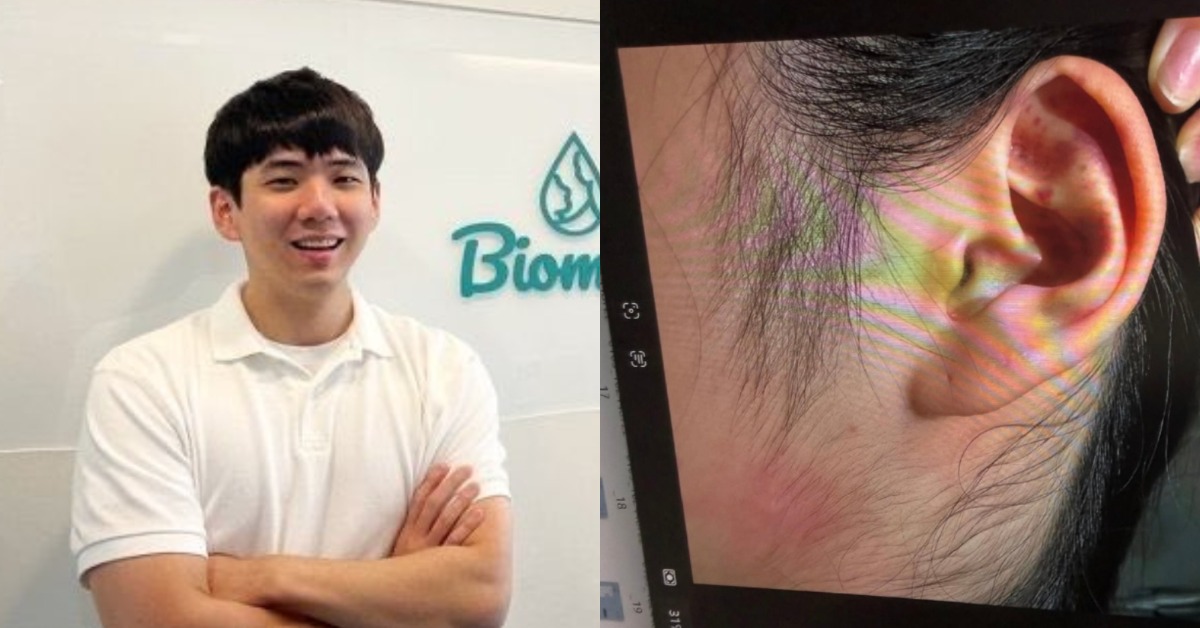 Jisoo哥哥金政勳（김준형，音譯）爆出性侵、家暴醜聞，其妻子也曬出傷照指控。（圖／翻攝自金政勳妻子 IG）