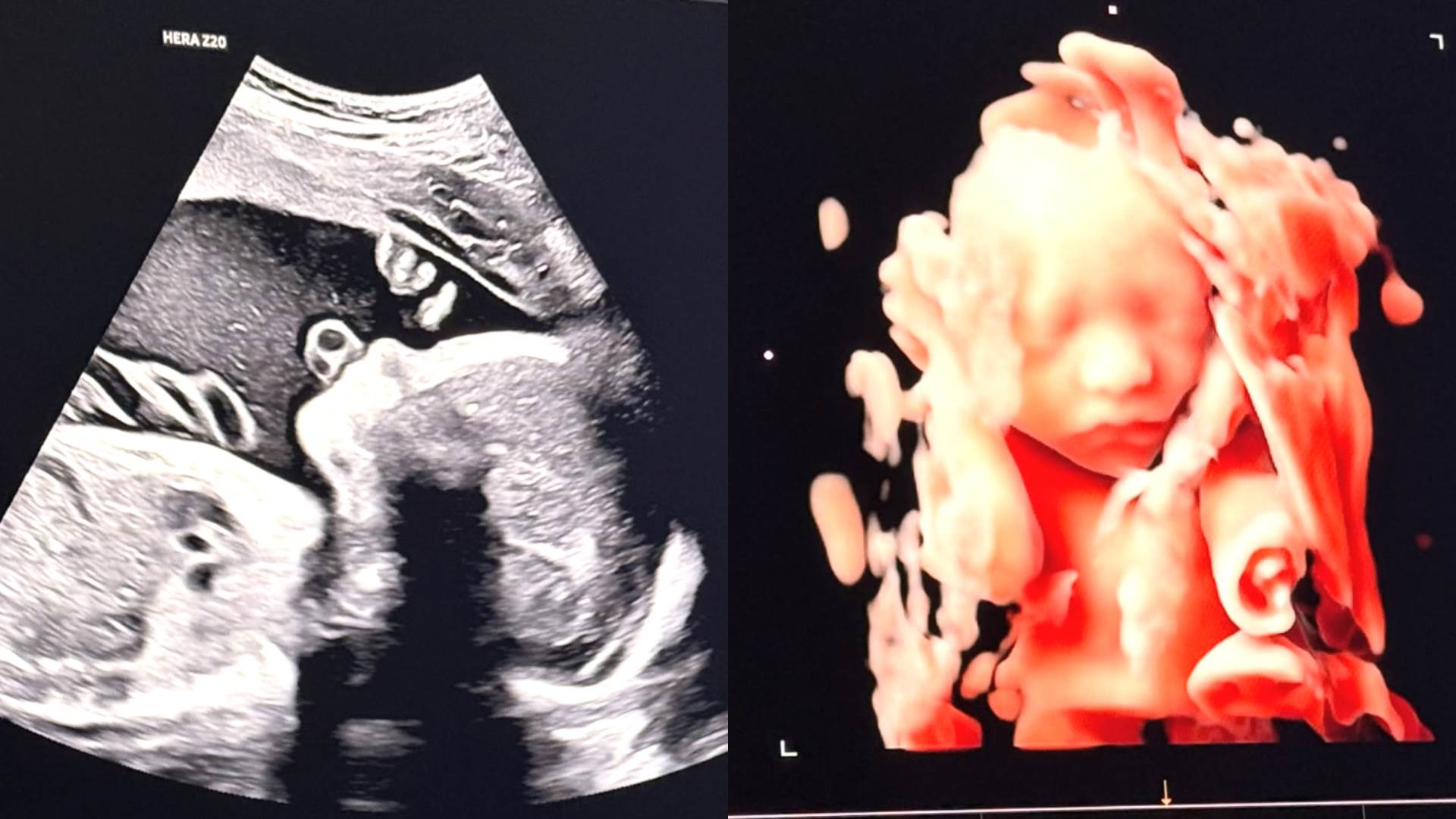 宋承炫曬超音波照宣布即將成為父親的喜訊。（圖／翻攝自宋承炫IG）