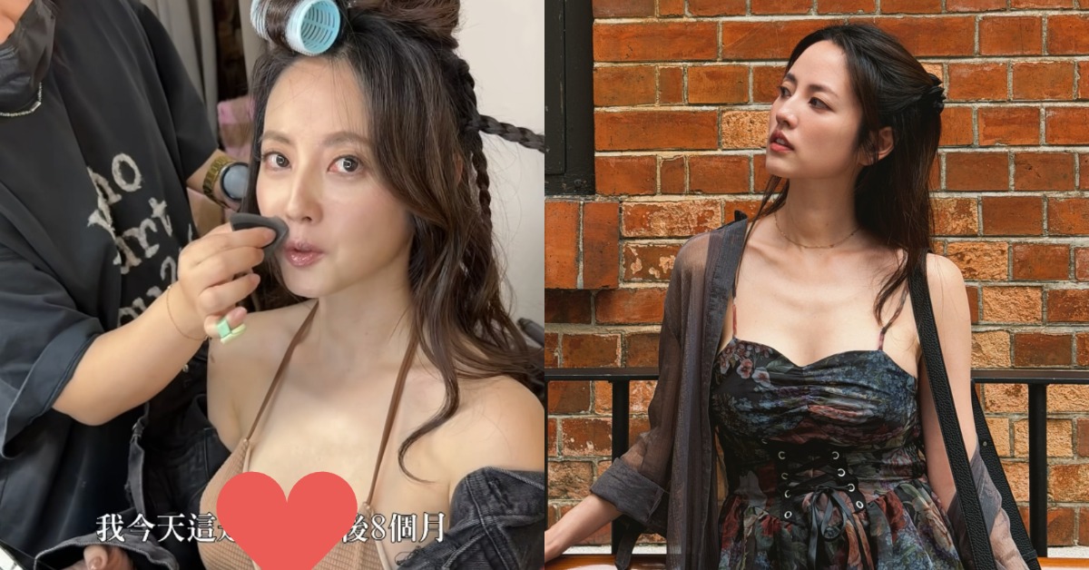 女星阿諾（涂珊）日前做了隆胸手術。（圖／翻攝自阿諾 臉書）