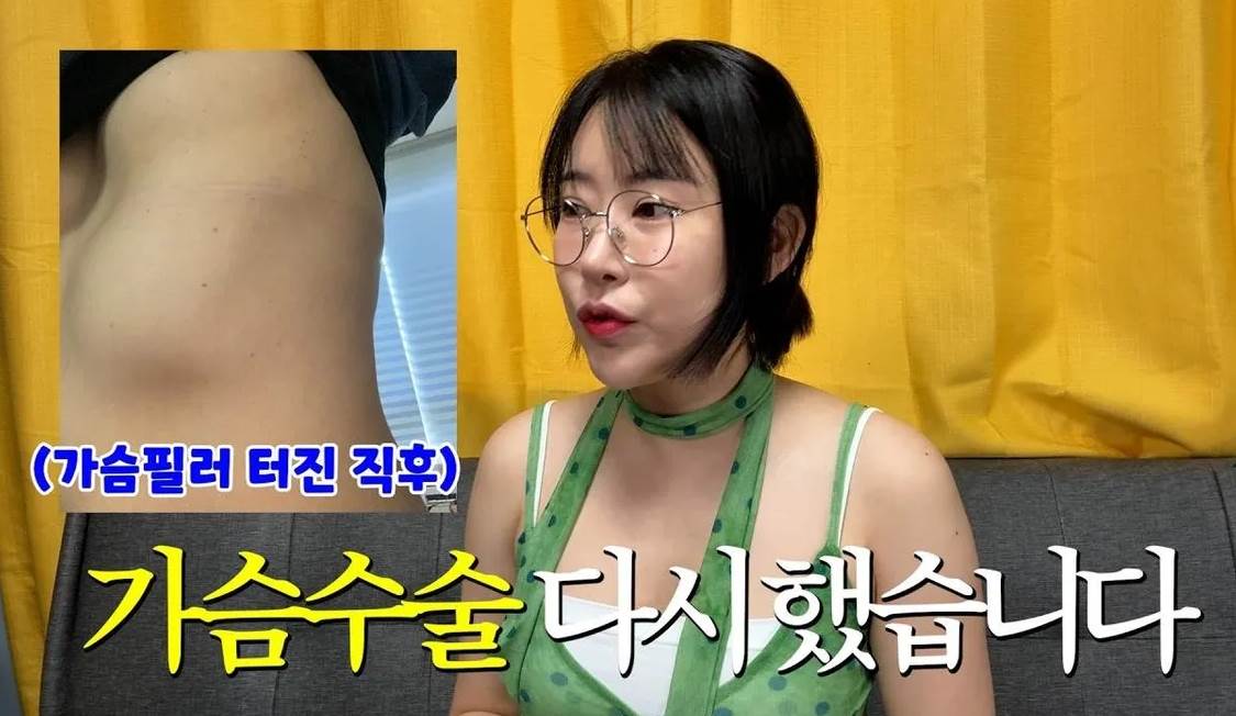 李世英公開隆乳位移的照片。（圖／翻攝自YouTube／영평티비 YPTV）