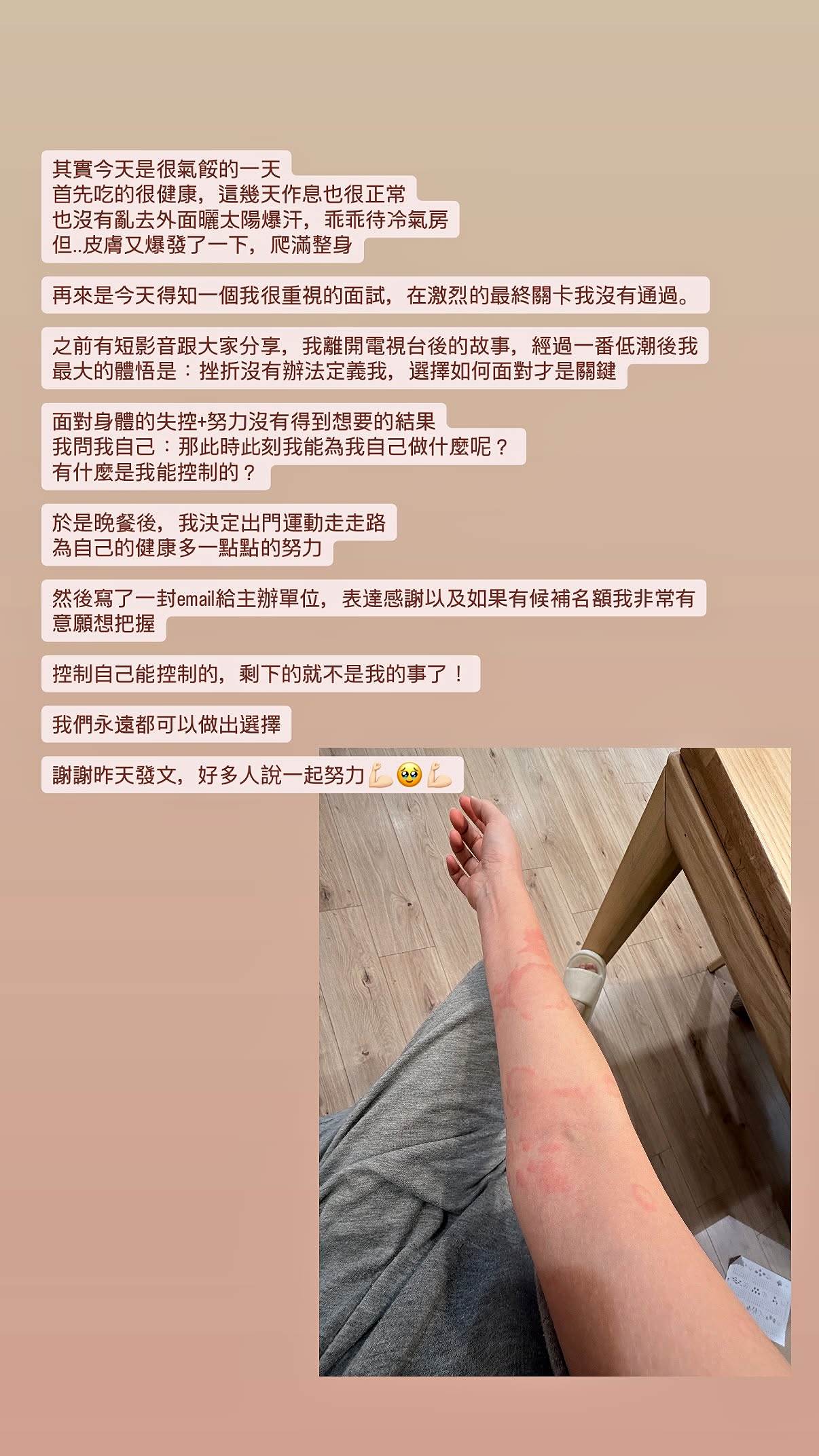 優格蕁麻疹再發作。（圖／翻攝自優格臉書）