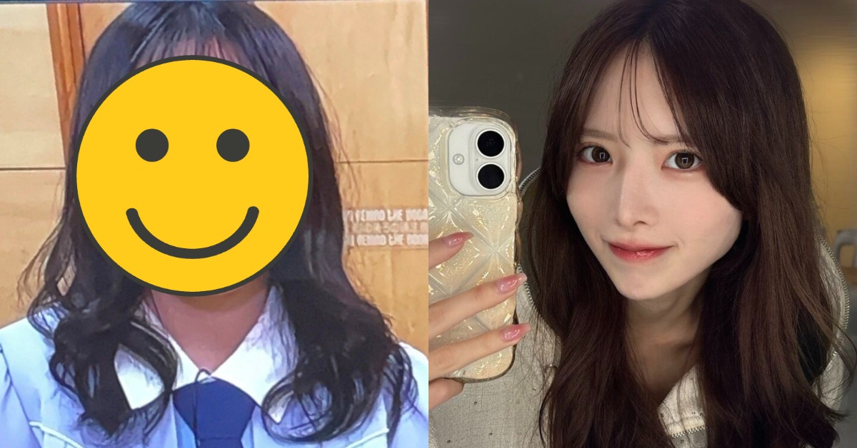 日本偶像女團STU48前成員榊美優曾因不滿意長相，花600萬日圓（約121萬元台幣）進行整形手術。（圖／翻攝自榊美優 X）