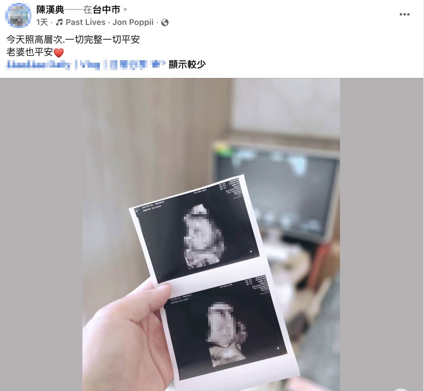 名為「陳漢典」的網友曬出超音波照，引發熱議。（圖／翻攝自臉書）